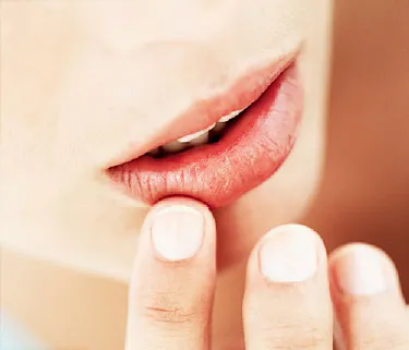 What are treatments for lip blisters?