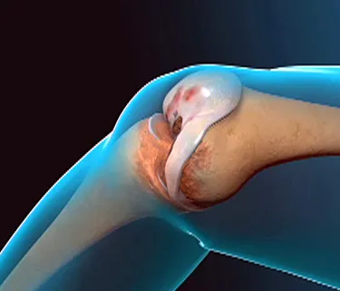 Where can you find knee replacement exercise videos?